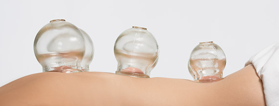 Schröpftherapie: Linderung durch Unterdruck